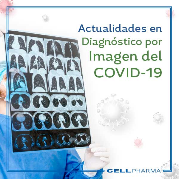 Actualidades en Diagnóstico por Imagen del COVID-19