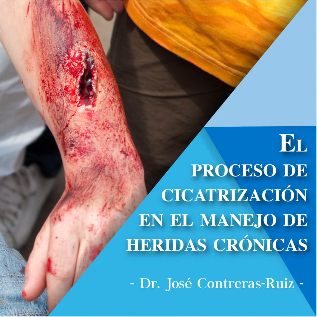 Manejo de heridas cronicas