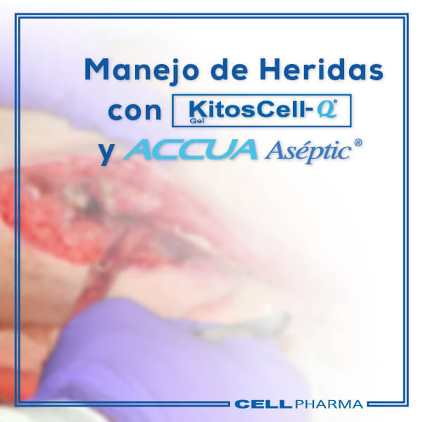 Manejo de Heridas